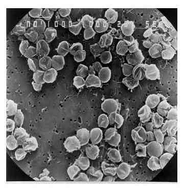 Pyrococcus abyssi