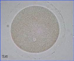 ovule