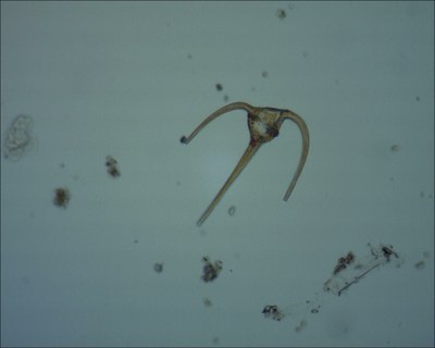 Ceratium horridum (dinoflagellé) Ceratium horridum (dinoflagellé)