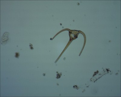 Ceratium horridum (dinoflagellé)