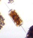 Ditylum sp (diatomée)