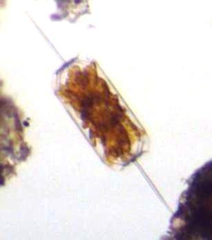 Ditylum sp (diatomée)