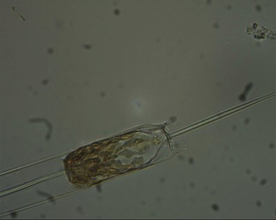 Ditylum brightwelli (diatomée)