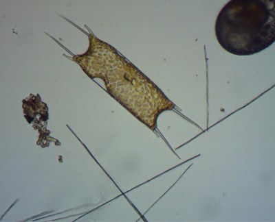 Pseudo-nitzschia (diatomée toxique) et Odontella sinensis (diatomée) Pseudo-nitzschia (diatomée toxique) et Odontella sinensis (diatomée)