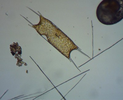 Pseudo-nitzschia (diatomée toxique) et Odontella sinensis (diatomée)