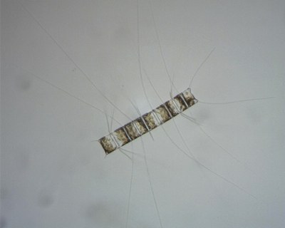 Chaetoceros sp. (Phytoplancton, Diatomée) Chaetoceros sp. (Phytoplancton, Diatomée)