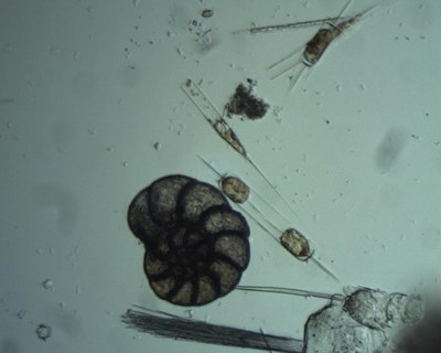 Foraminifère (zooplancton permanent) et Ditylum sp. (diatomée) Foraminifère (zooplancton permanent) et Ditylum sp. (diatomée)