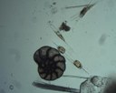 Foraminifère (zooplancton permanent) et Ditylum sp. (diatomée)
