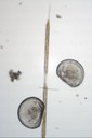 larve de moule (Zooplancton temporaire) et Rhizosolenia (diatomée)
