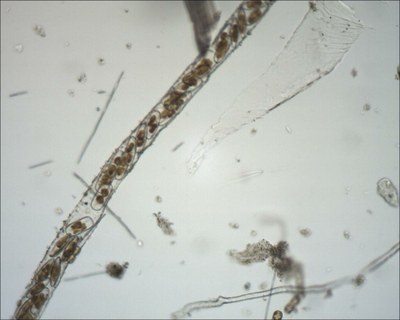 Navicules dans un manchon muqueux (diatomées) Navicules dans un manchon muqueux (diatomées)