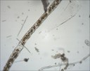 Navicules dans un manchon muqueux (diatomées)