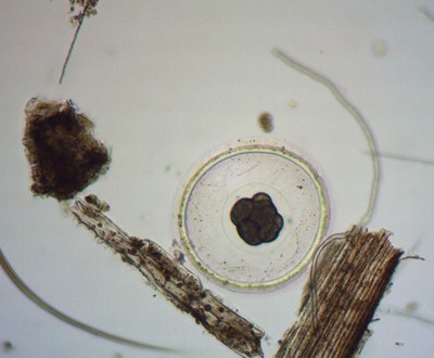 Embryon de 8 cellules (zooplancton) Embryon de 8 cellules (zooplancton)