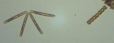 Thalassionema  nitzschioides et Chaetoceros sp. (diatomées)