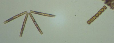 Thalassionema nitzschioides et Chaetoceros sp. (diatomées) Thalassionema nitzschioides et Chaetoceros sp. (diatomées)