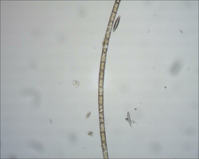 Melosira Melosira